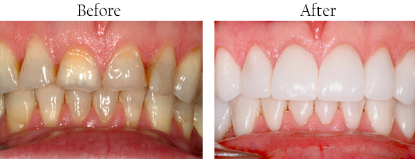 dental images 11010